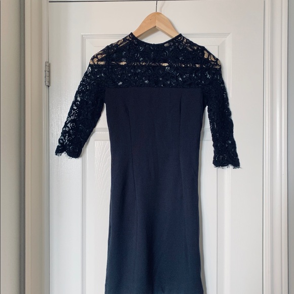 Black BB Dakota dress with lace detail - Picture 5 of 6